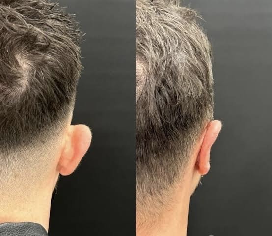 Chirurgo per mastoplastica a Caserta