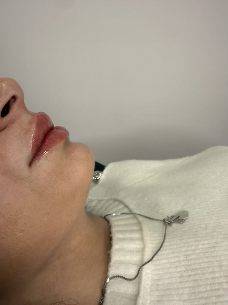 IMG_5079 Chirurgo per mastoplastica a Caserta