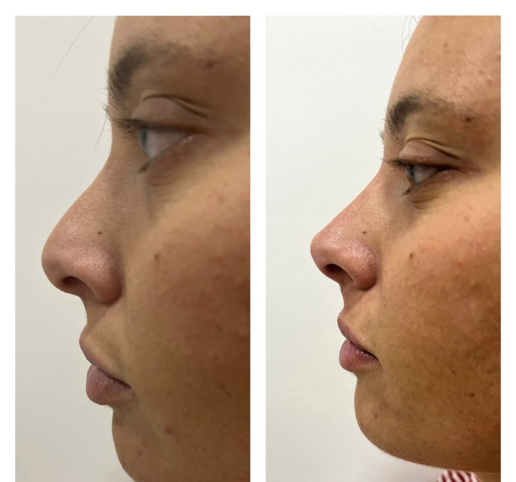 a604c46d-4e0e-4337-9348-7a2a1bd8d823 Chirurgo per blefaroplastica a Caserta